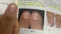 女生從教科書上發(fā)現(xiàn)自己生病了：學(xué)醫(yī)最有用的一次